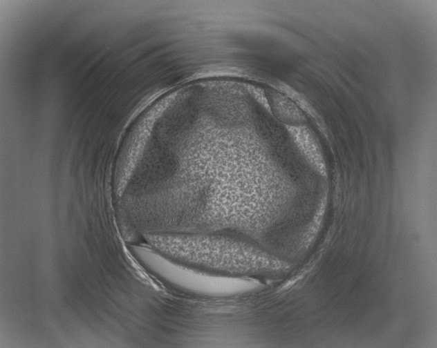 X0000082761137200702162018