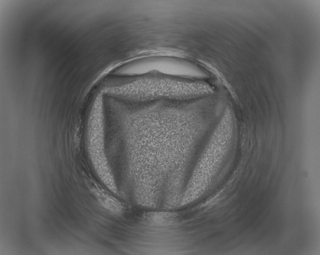 X0000082761163200702162018