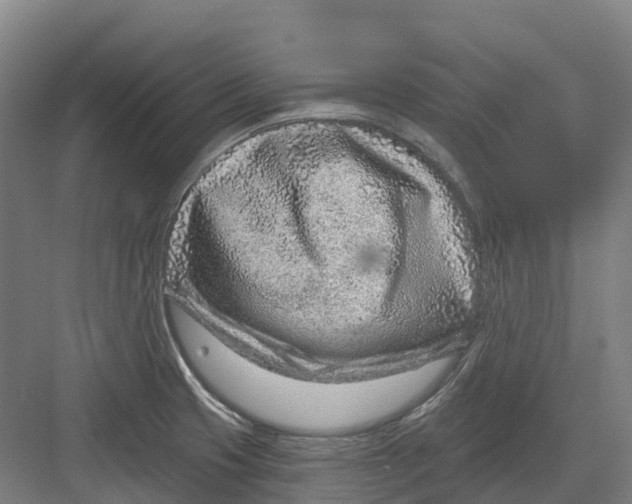 X0000082761425200702162014