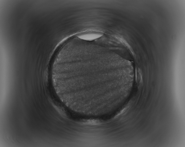 X0000082930204200703020113