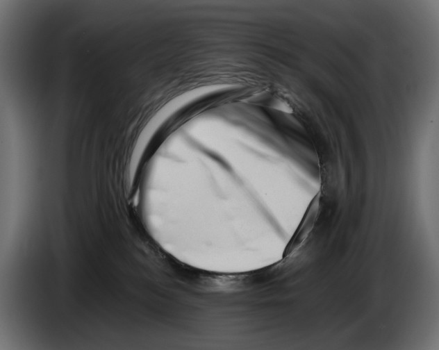 X0000082950184200703020158