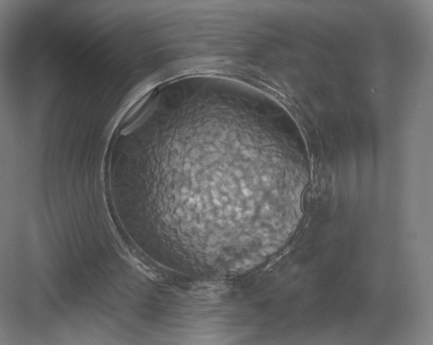 X0000082960099200702152316