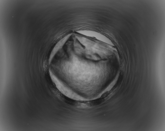 X0000082960285200703020219