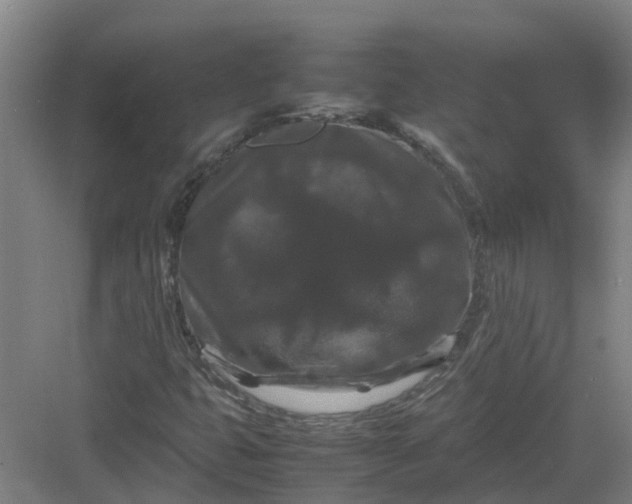 X0000082971399200702152320
