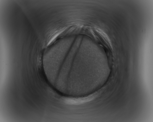 X0000082970017200703020244