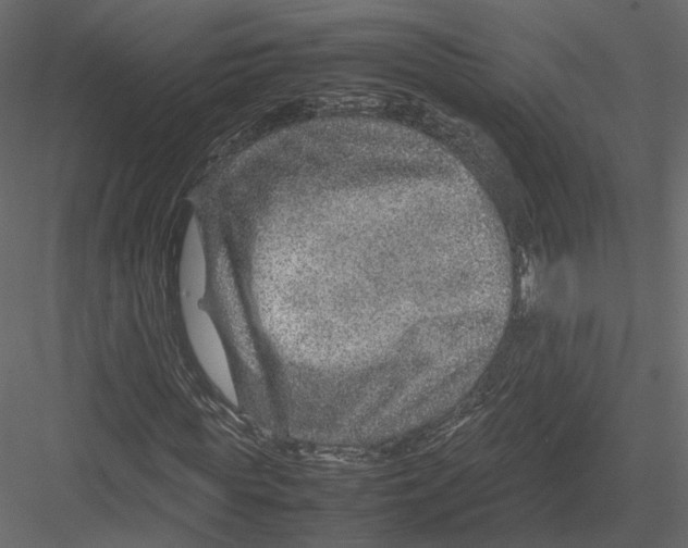 X0000082990819200702230057