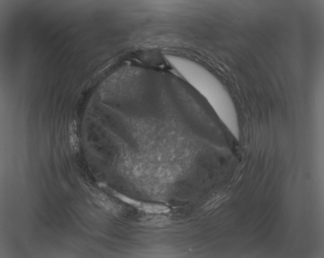 X0000082991156200702230052