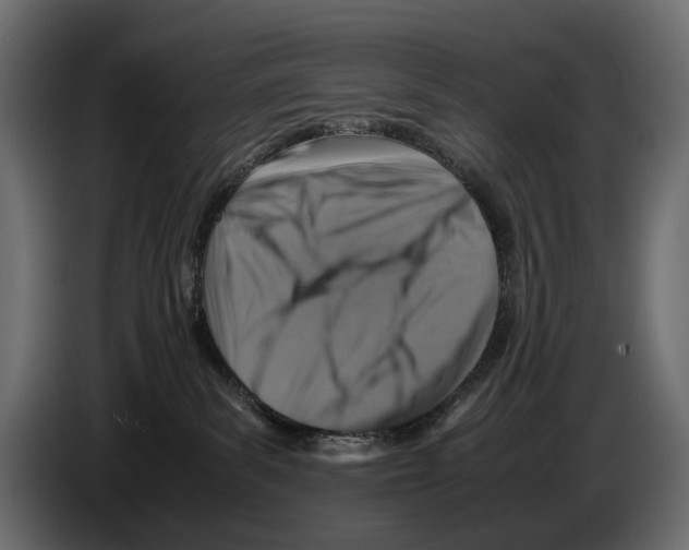 X0000082990139200703020852