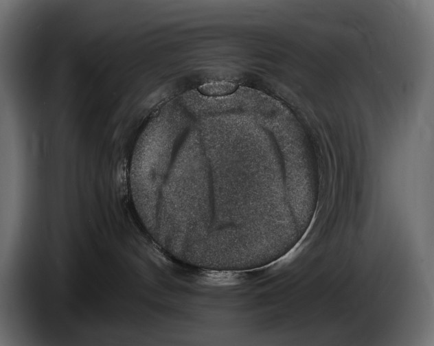 X0000082990144200703020851