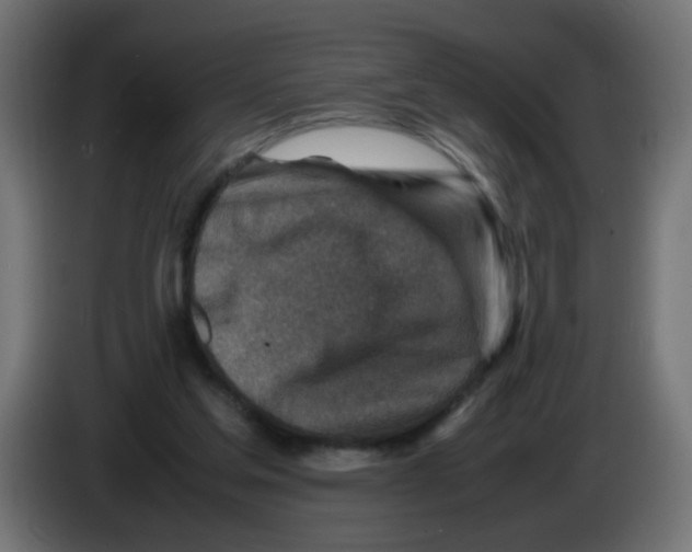 X0000083030205200703022034