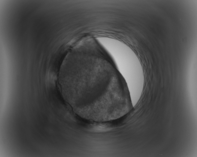 X0000083030235200703022033