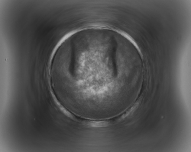 X0000083031381200703022016