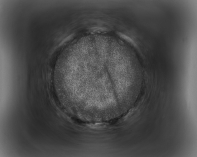 X0000083031399200703022016