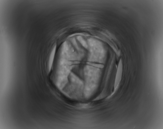 X0000083040170200703022056