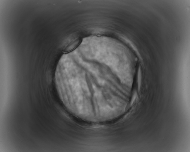 X0000083040257200703022055