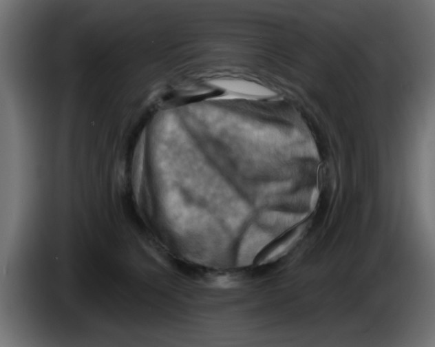 X0000083040564200703022051