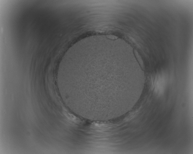 X0000083050817200702091435