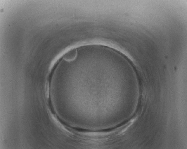 X0000083561510200702162014