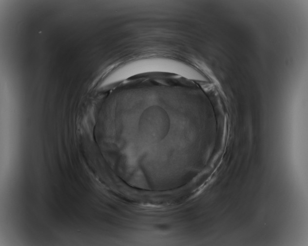 X0000083560154200703021729