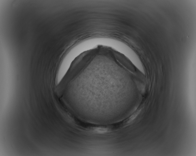 X0000083560168200703021729