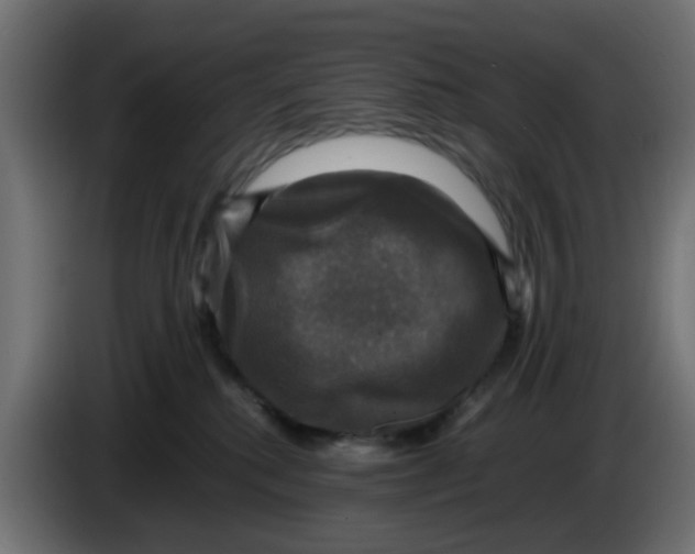 X0000083560280200703021727