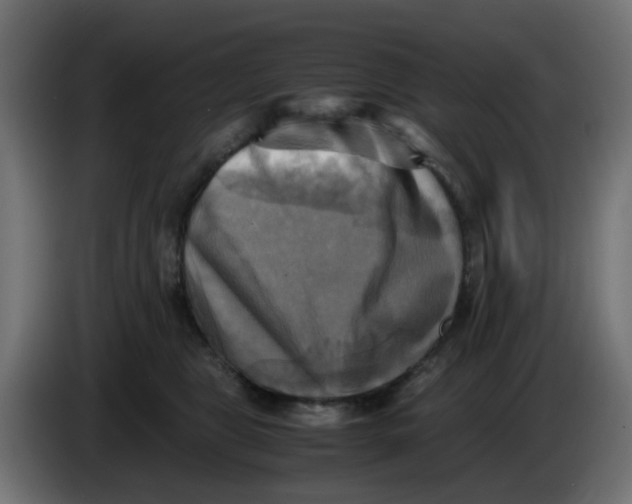 X0000083560469200703021724