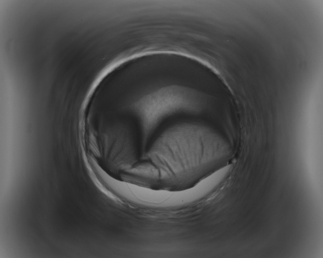 X0000083561519200703021704