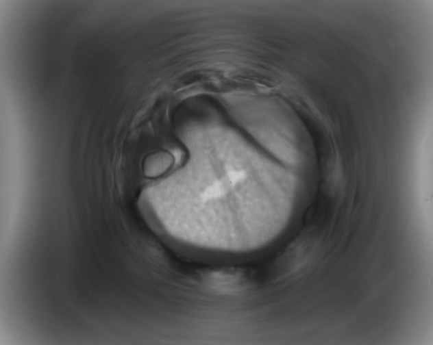 X0000083560232200703091623