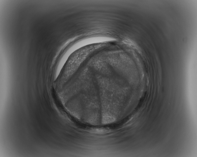 X0000083560540200703091618