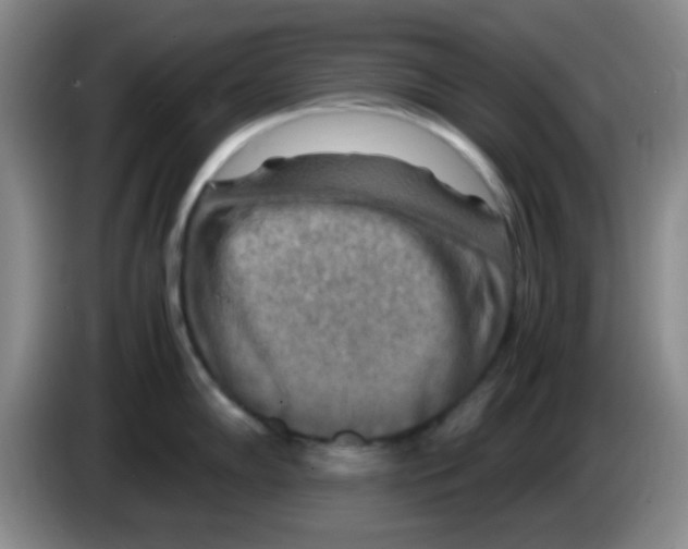 X0000083561102200703091611