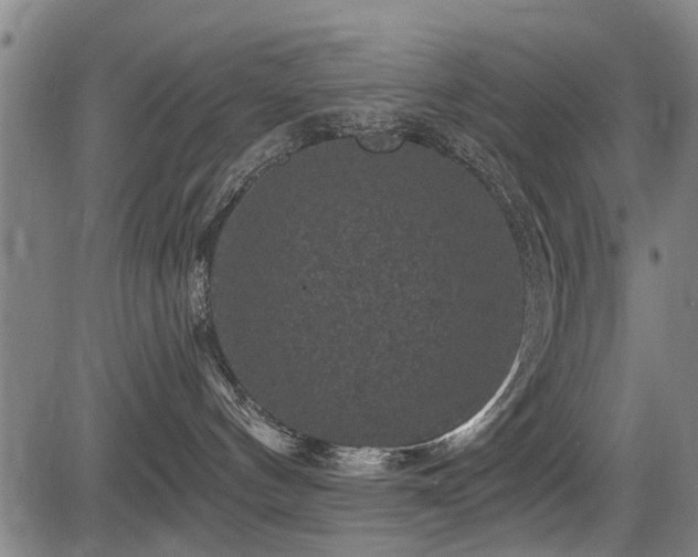 X0000083570144200702091103