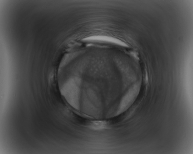 X0000083570233200703021755