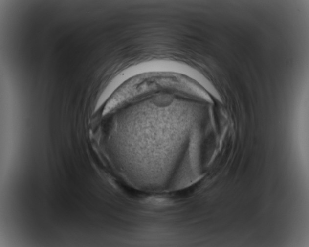 X0000083570280200703021755