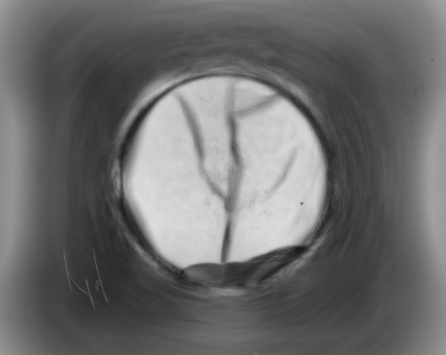 X0000083571509200703091626