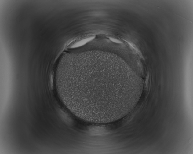 X0000083580110200703021827