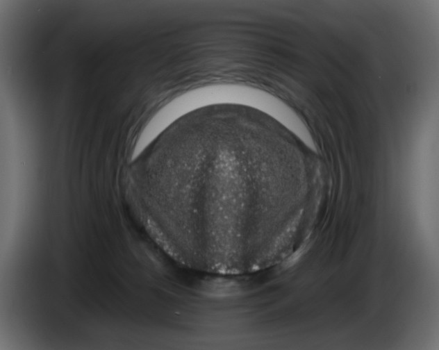 X0000083580180200703021826