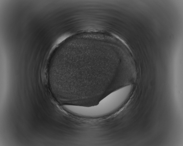 X0000083581018200703021809