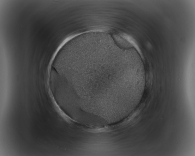 X0000083581099200703021809