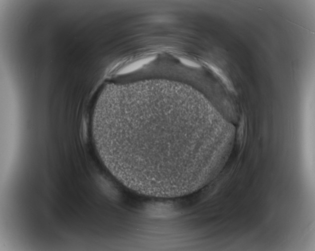 X0000083580110200703091706