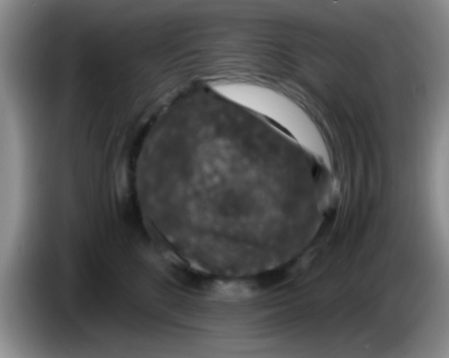 X0000083580520200703091701