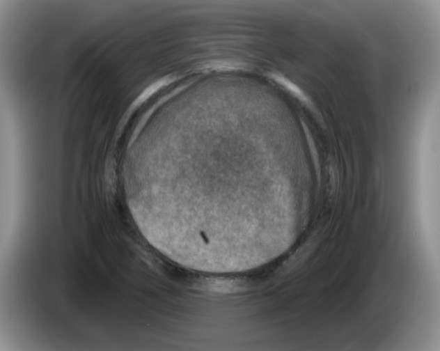 X0000083581266200703091651