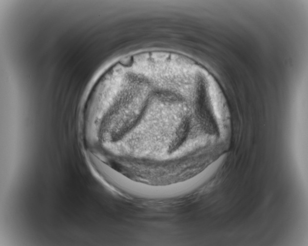 X0000083581527200703091648