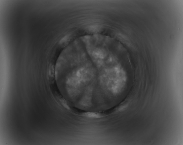 X0000083590528200703021848