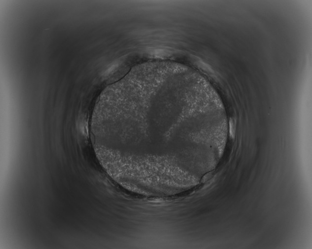 X0000083591155200703021836