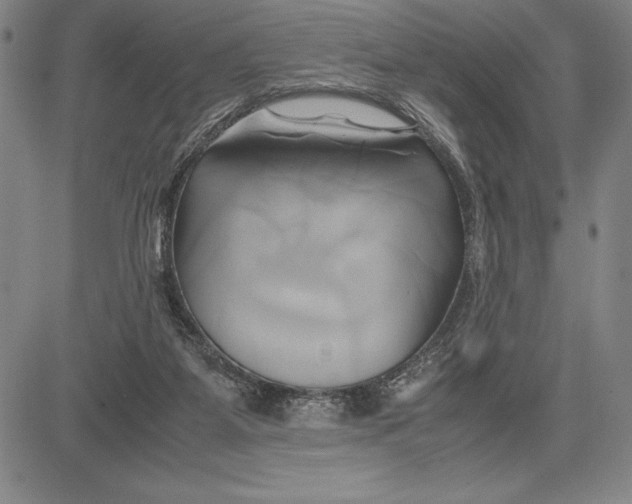 X0000083620115200703051619