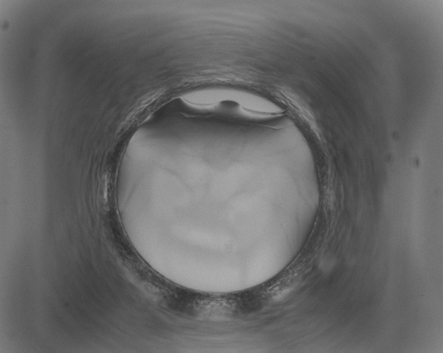 X0000083620115200703121638