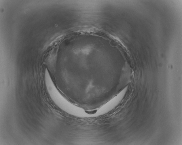 X0000083651399200702261104
