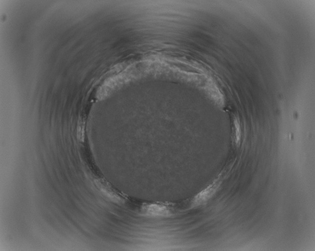 X0000083650180200703051735