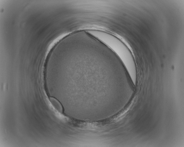 X0000083660995200702261137