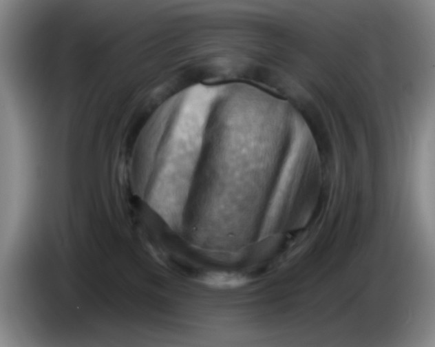 X0000083970137200703091811